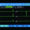 Gnx Color-TFT-Display-1614343271 BPL Cardiart 3-channel ECG Machine GenX3